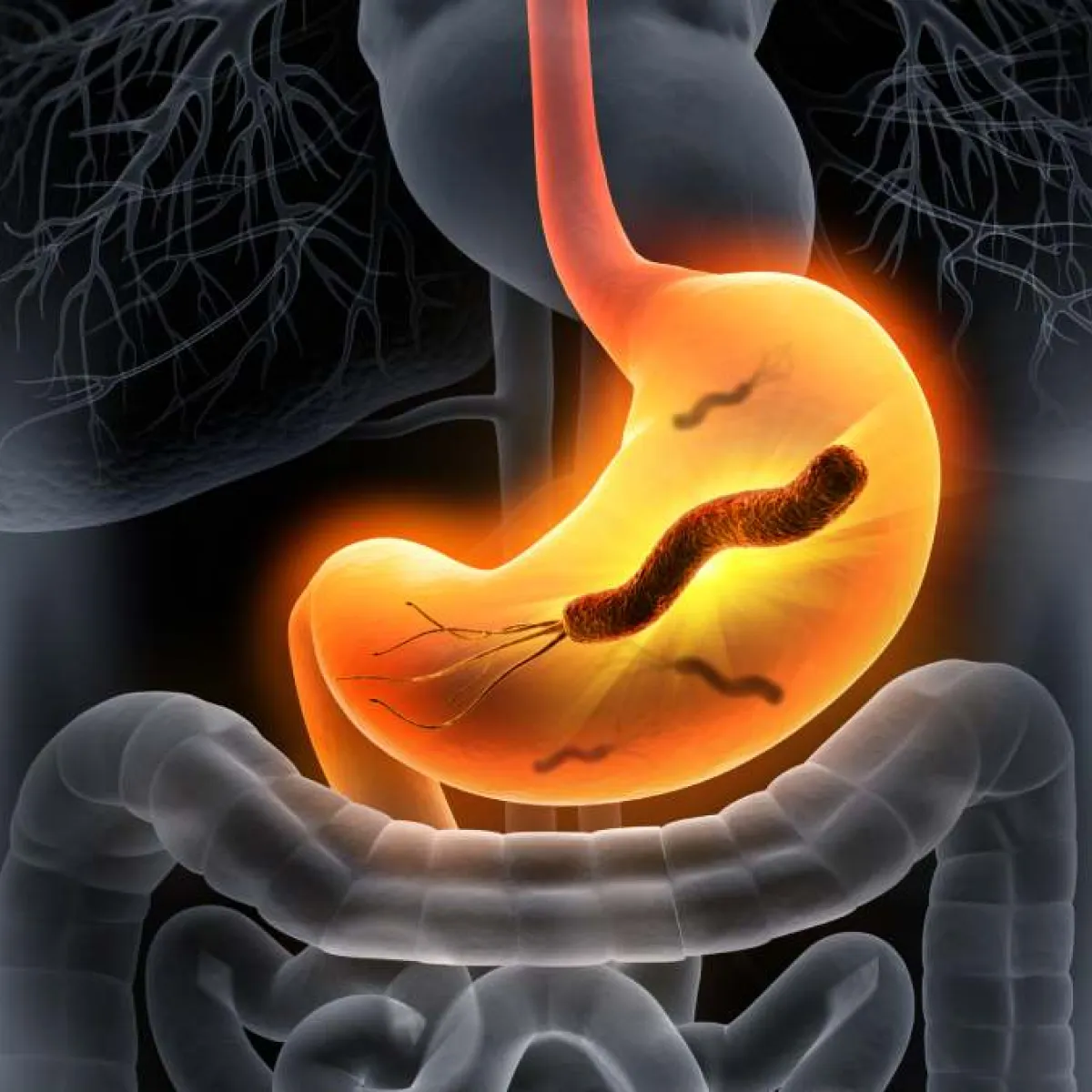 Helicobacter pylori: qué es, síntomas y tratamiento