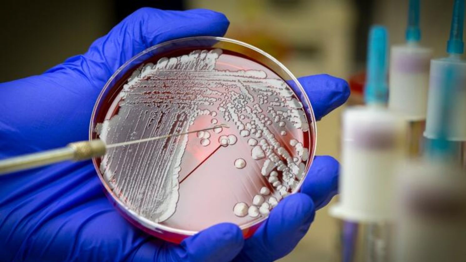 Qué es la “bacteria come carne” de la que se ha hablado en redes sociales