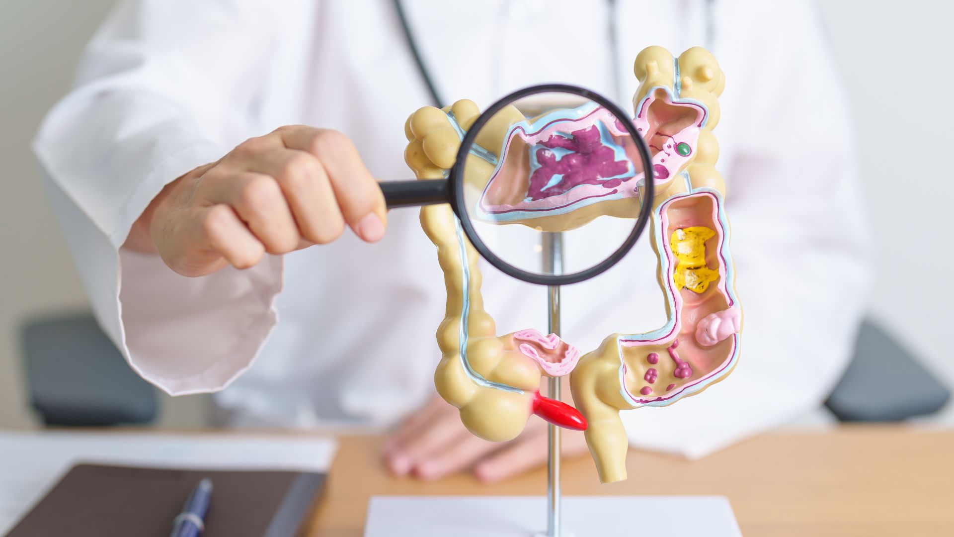 Cáncer de colon: una amenaza silenciosa que puede prevenirse con detección temprana