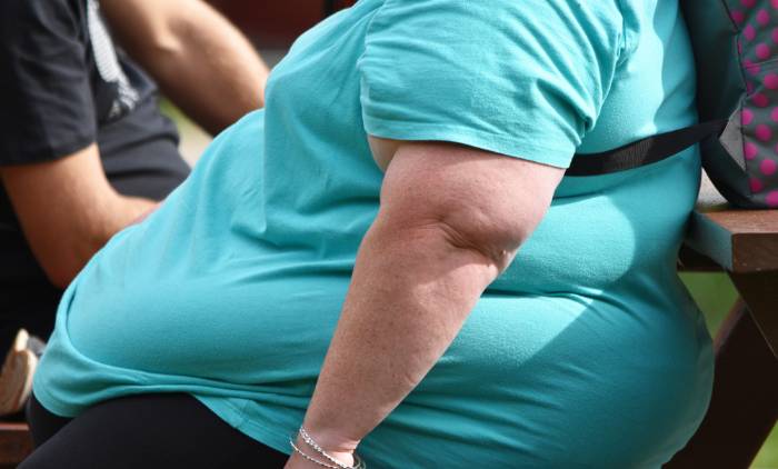 Estudio revela cirugía combinada en pacientes con obesidad severa ofrece mejores resultados