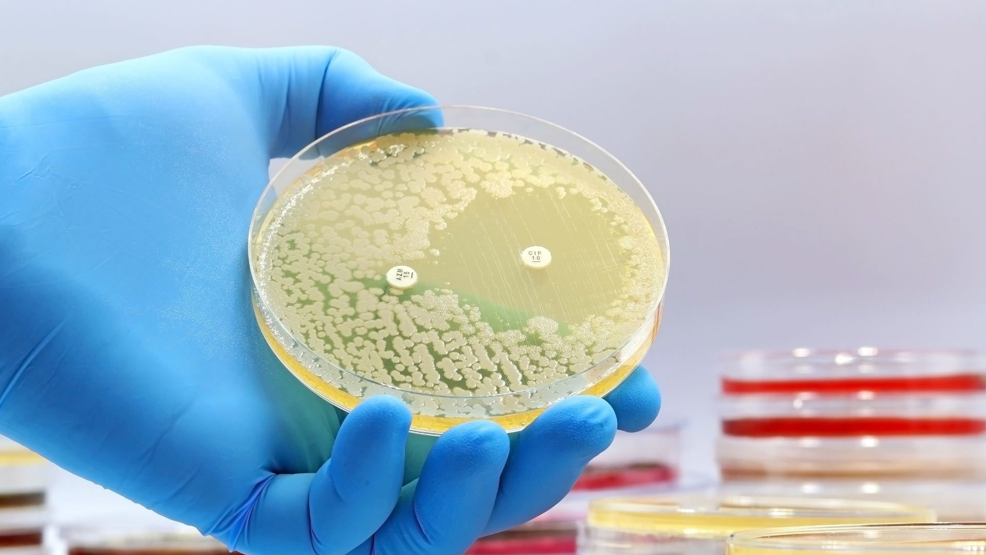 La OMS alerta sobre la creciente resistencia global de las bacterias a los antibióticos