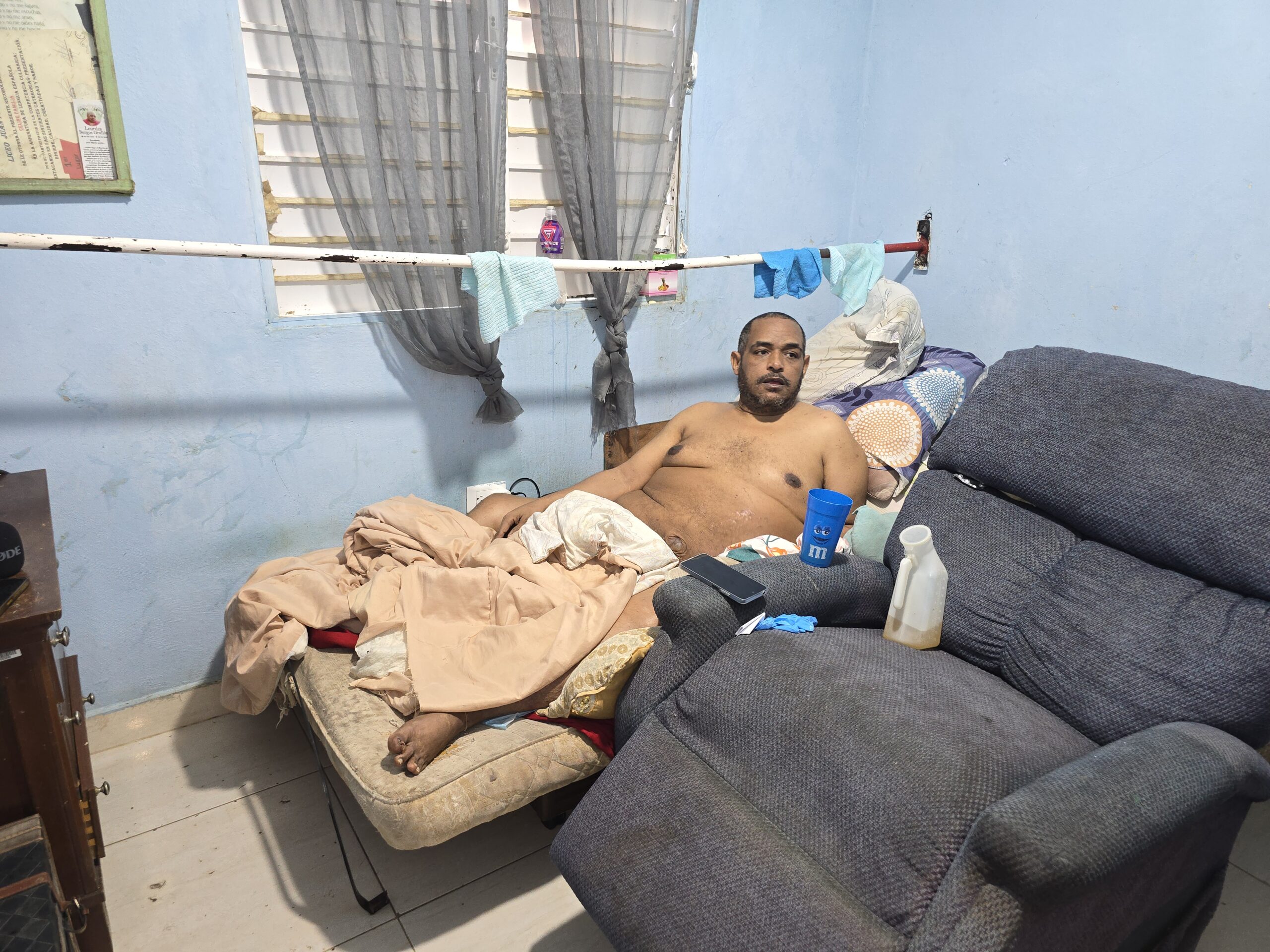 El linfedema: un peso que aplasta la vida de Joan Batista