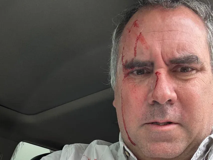 Candidato presidencial de Perú sobrevive tras ataque a tiros a su vehículo