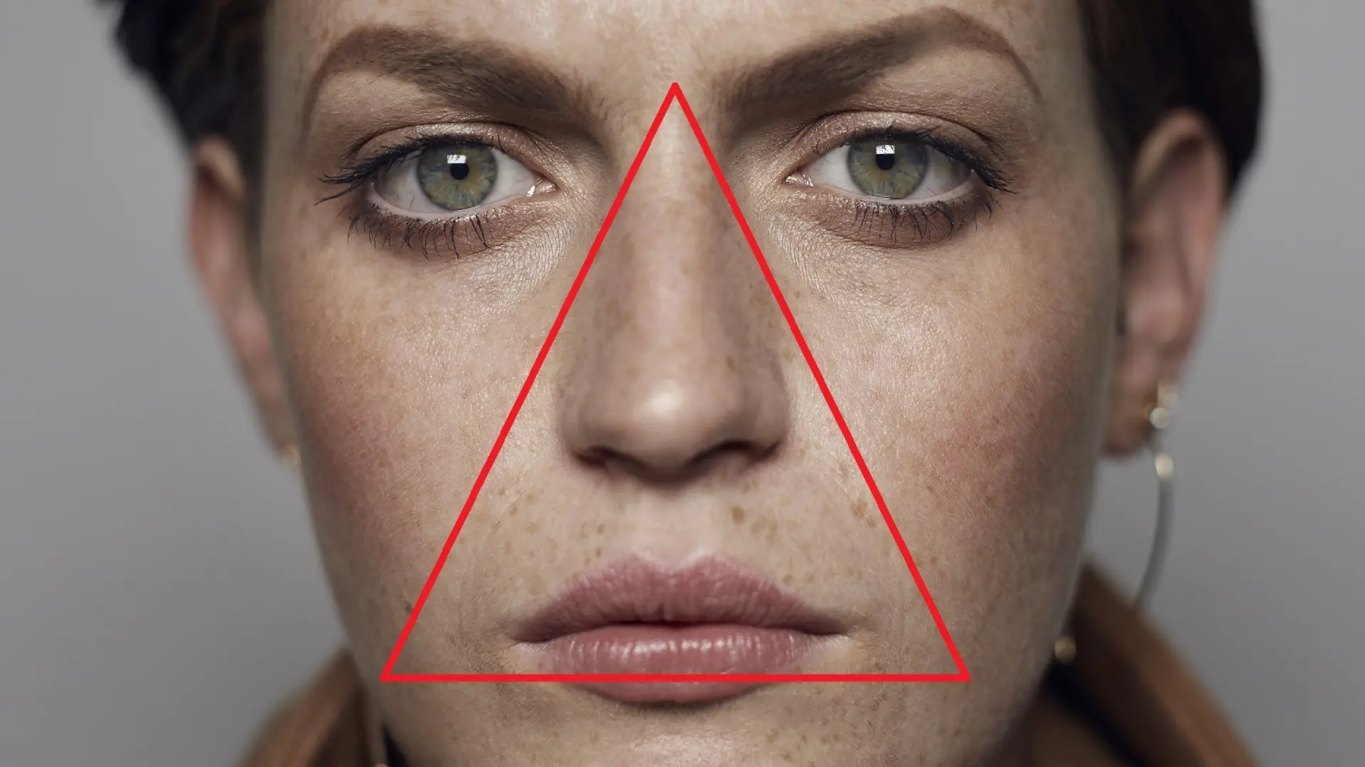 Quitarse un grano en «el triángulo de la muerte». ¿Es peligroso?