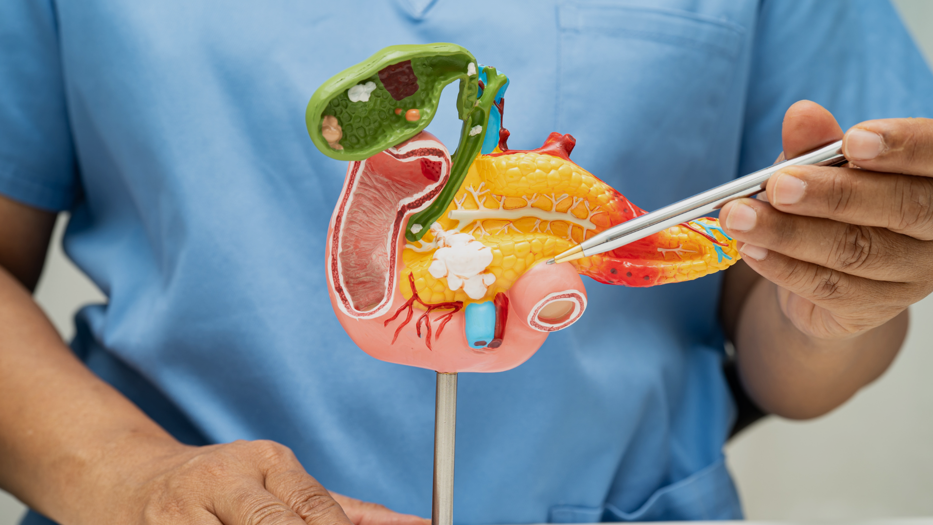 Investigadores españoles eliminan, por primera vez, el cáncer de páncreas en ratones