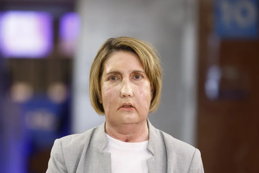 Completan el primer trasplante de cara del mundo con una donante de eutanasia