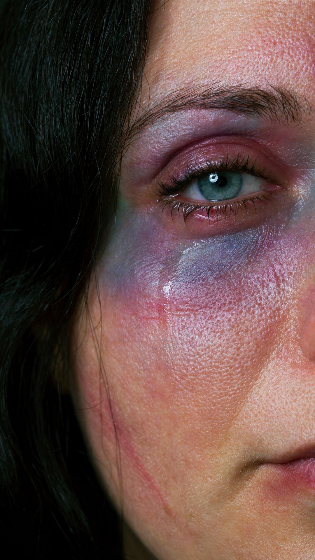 Mujer denuncia agresión por parte de su expareja en Sabana Yegua