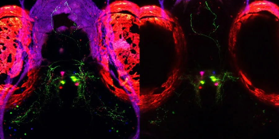 Una investigación sobre el sueño en peces podría abrir vías para tratar el insomnio en humanos