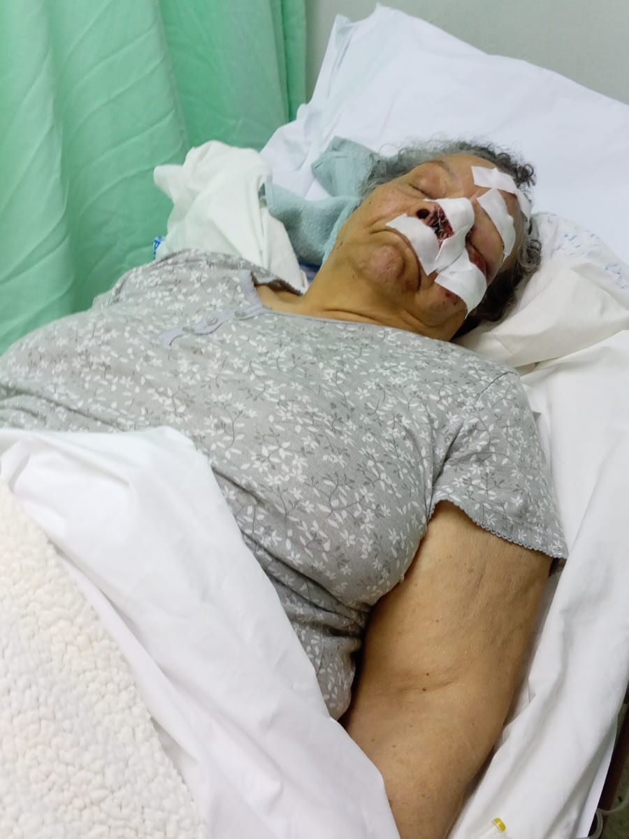 Señora de 79 años resulta herida por un peñón lanzado desde un puente en SDE