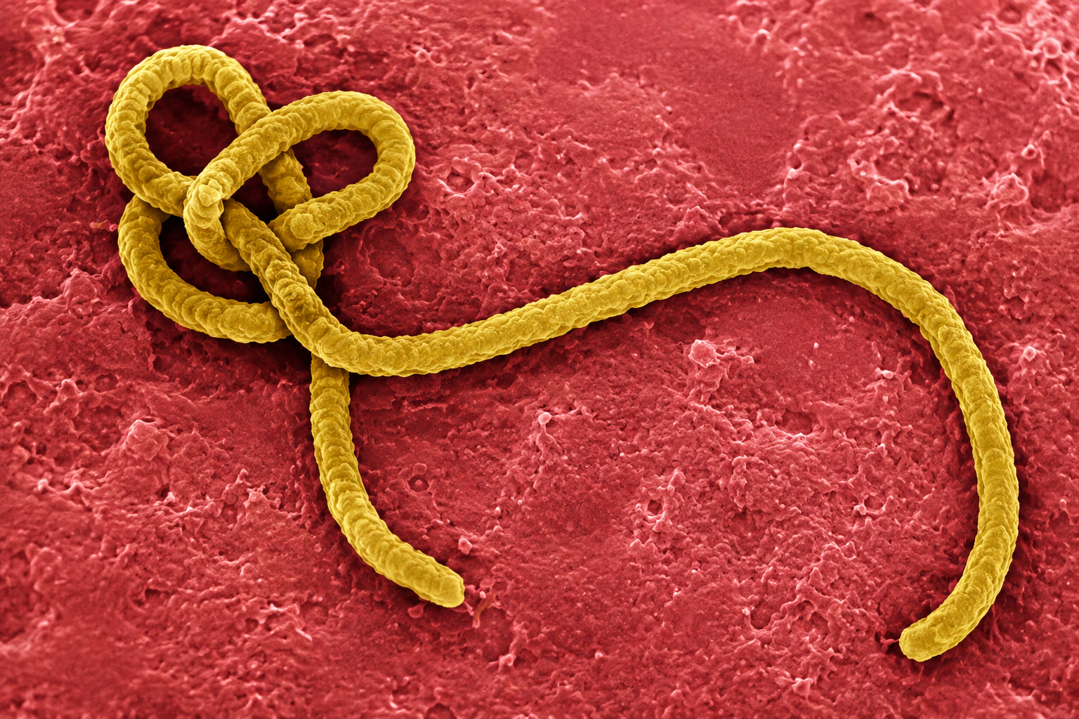 ¿Cuántos brotes y fallecimientos ha registrado la RD del Congo desde la primera aparición del virus ébola?