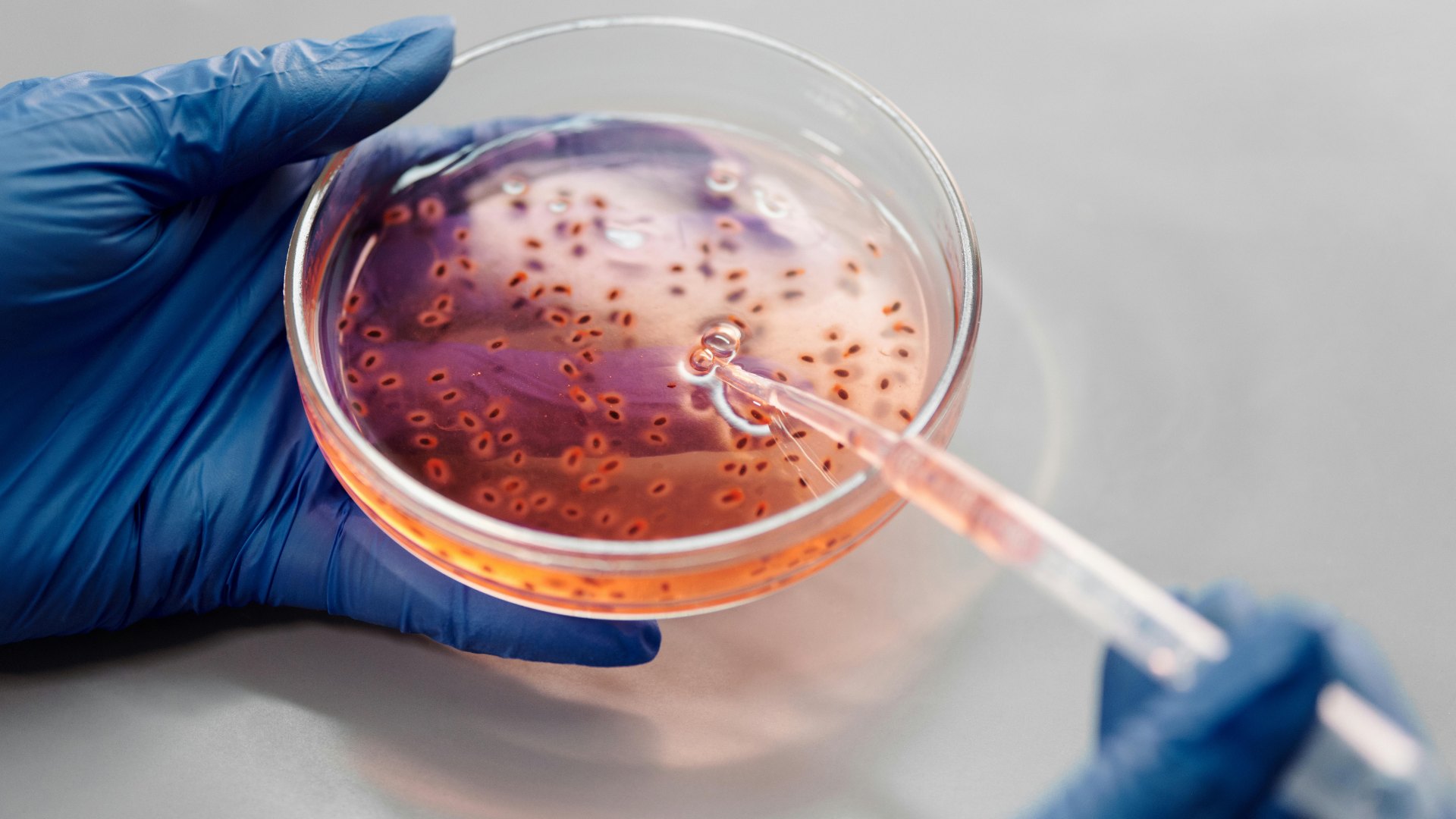 Hallazgo científico abre vía para combatir bacterias resistentes a antibióticos